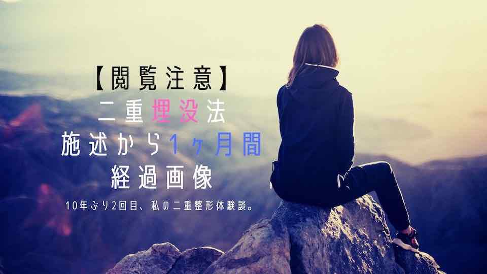 口コミ 二重 手術 失敗しない二重整形クリニック紹介 最新版｜クチコミ情報、体験談多数